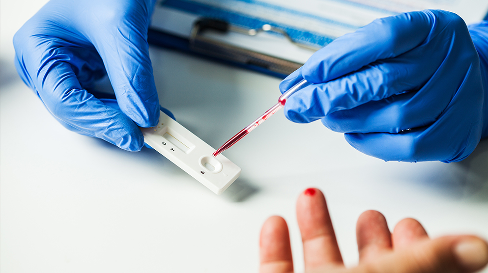 Τεστ Ταχείας Ανίχνευσης Αντιγόνου (rapid test) για Covid-19 και Γρίπη